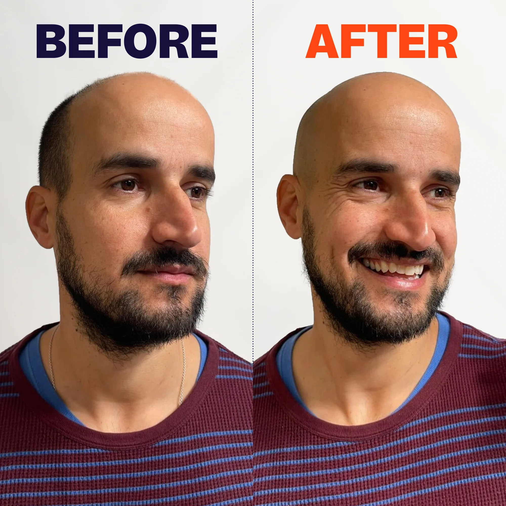 FlexSeries® Pro Shaving Kit - Image 4